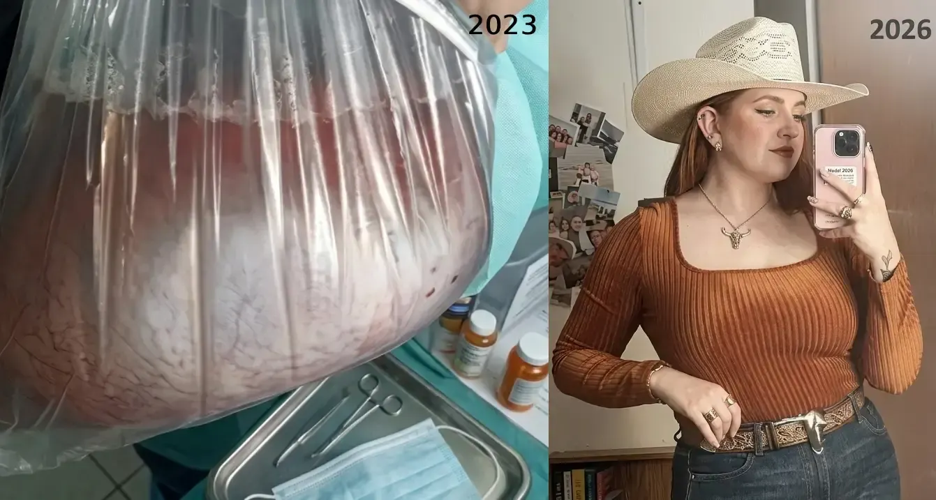 Fotografías clínicas de la afección y recuperación de Anna Victoria de 2023 y 2026